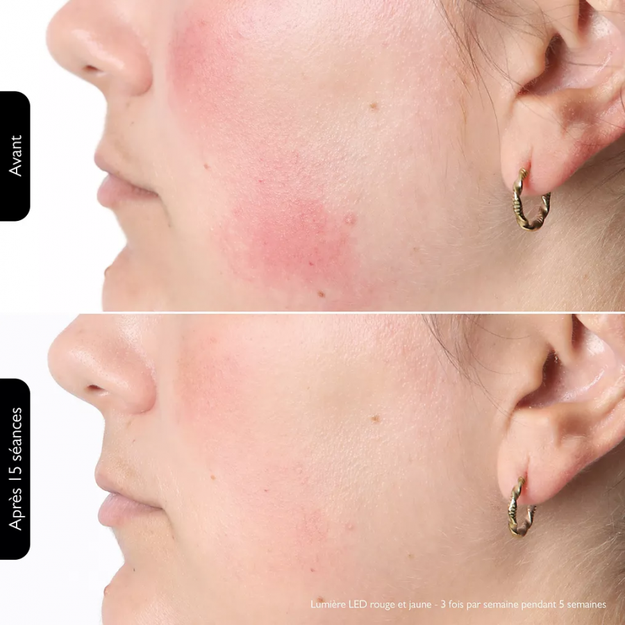 SILKN LED FACEMASK100 n°7