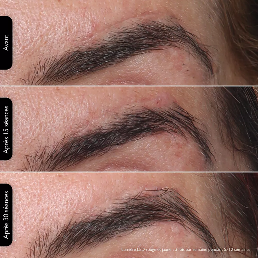 SILKN LED FACEMASK100 n°8