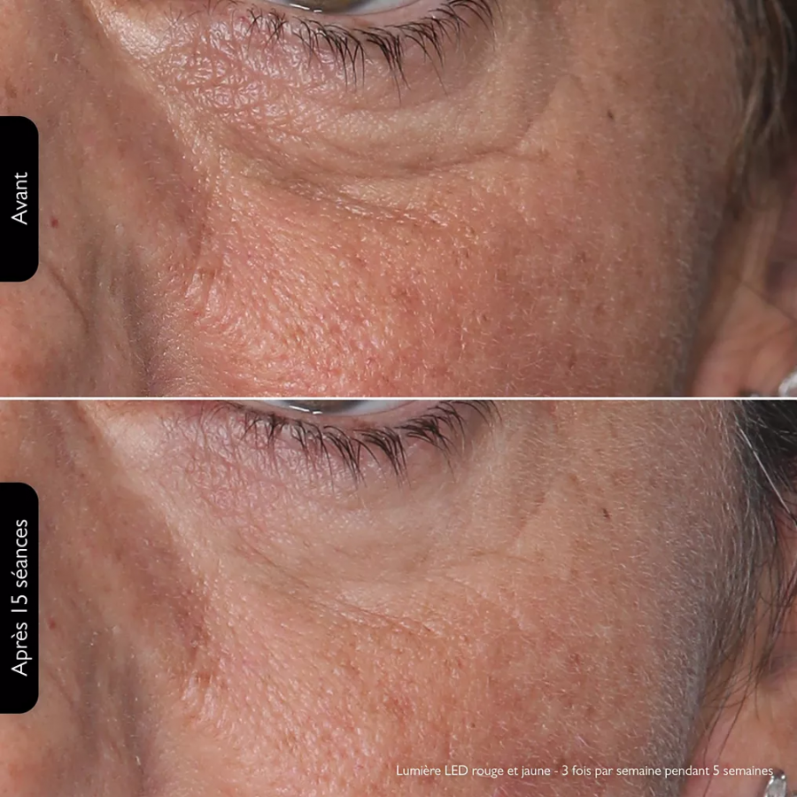 SILKN LED FACEMASK100 n°9